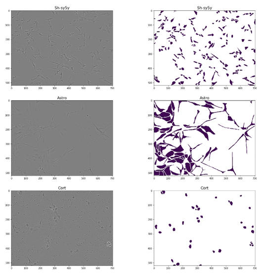 Sartorius Neuronal Cells Segmentation